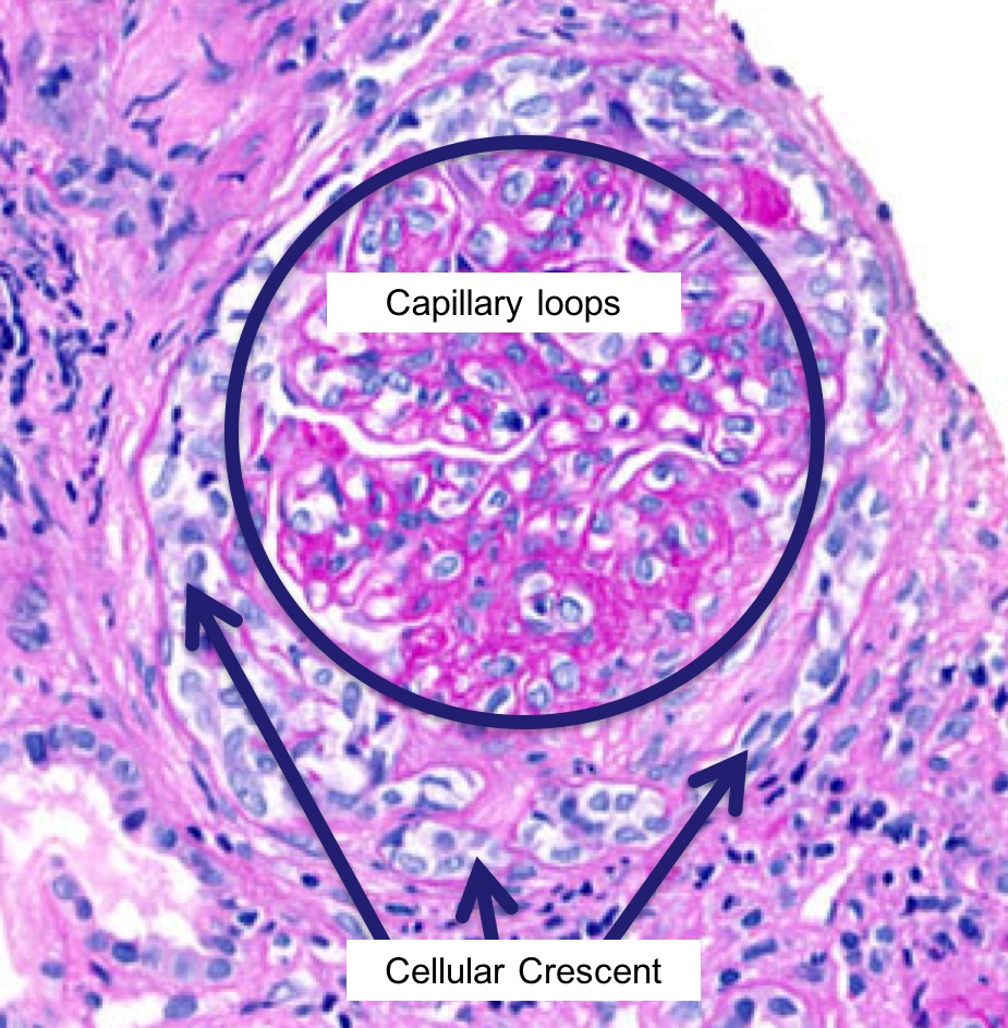 Histologie glomerulară
